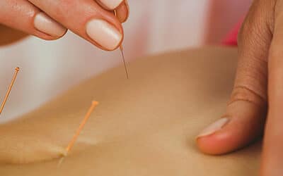 Acupuntura para el Dolor Lumbar: Alivio Natural y Efectivo