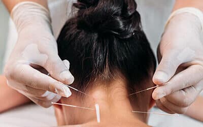 Tratamiento Natural para la Menopausia con Acupuntura y Medicina China