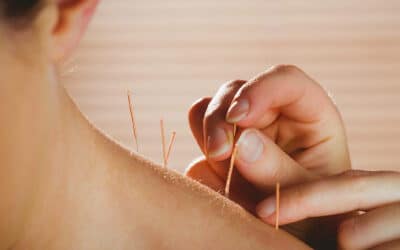 ¿Cómo funciona la Acupuntura?